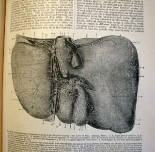 Rare Antique Medical Book Over 100 years Old Lithos illustrations 