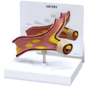 Artery Section Model  Industrial & Scientific