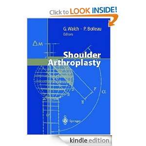 Shoulder Arthroplasty Gilles Walch, Pascal Boileau, N. Gschwend, R.J 