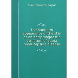  symptom of supra renal capsule disease Isaac Ebenezer Taylor Books